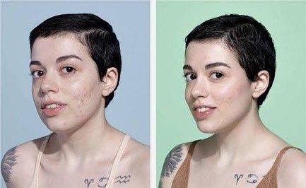 Linha Antiacne para Sallve — imagem 4