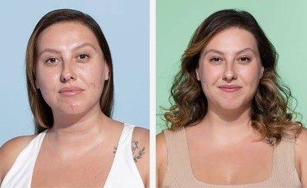 Linha Antiacne para Sallve — imagem 6
