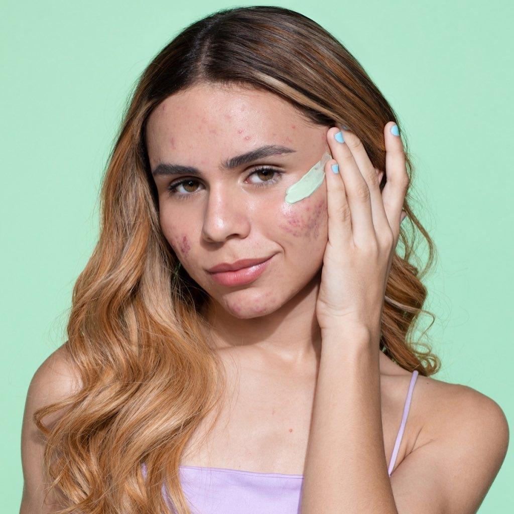 Linha Antiacne para Sallve — imagem 7