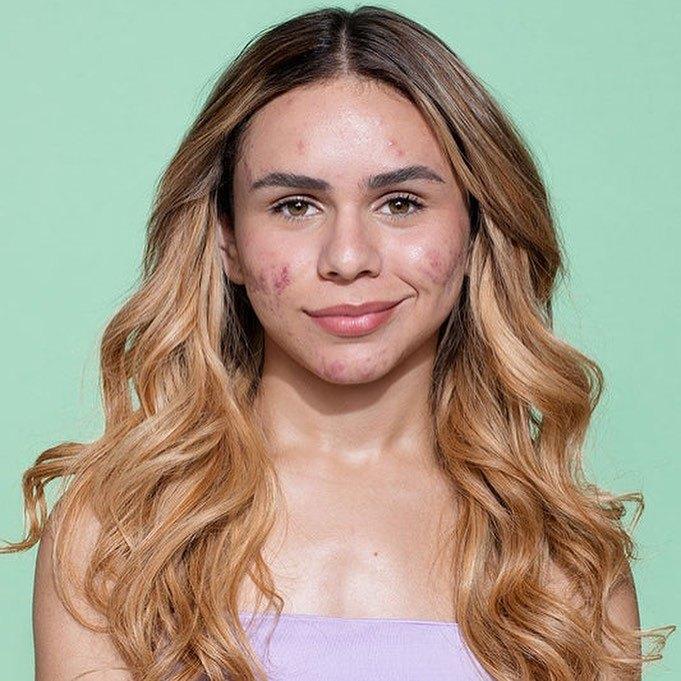 Linha Antiacne para Sallve — imagem 8